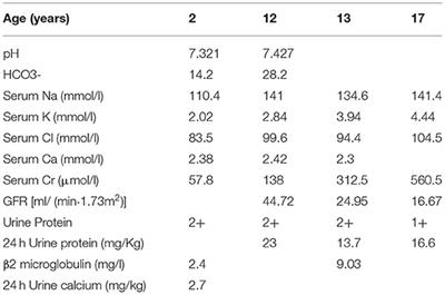 Bartter-Like Syndrome as the Initial Presentation of Dent Disease 1: A Case Report